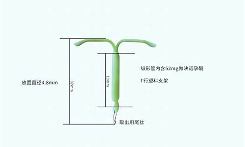 曼月乐尾丝是金属材料(曼月乐环尾丝是金属吗)